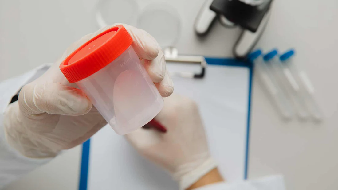 Sperm Donation Sydney – Life Fertility Clinic Sydney